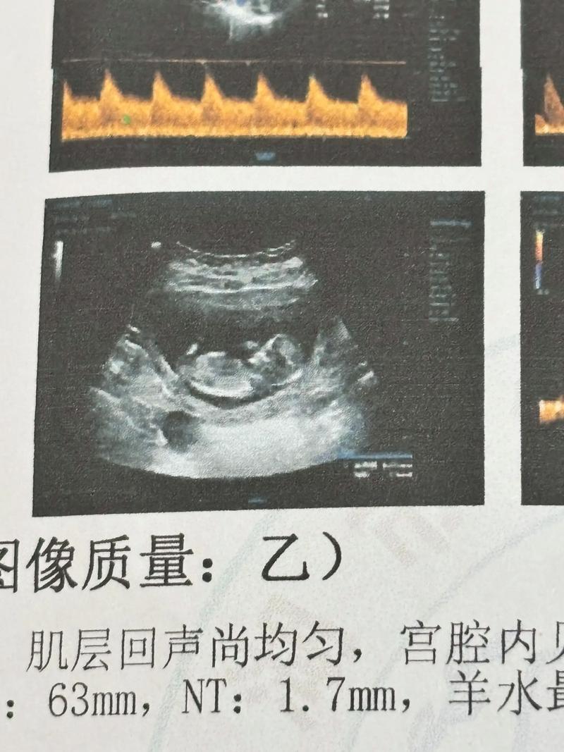 12周nt两腿之间什么都没有-图1